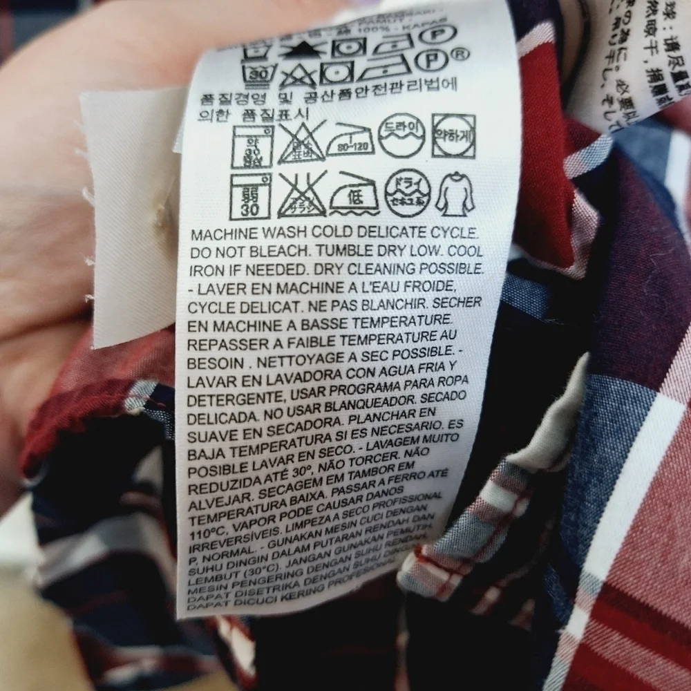 Levis discoloration photo see